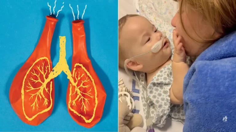 O que é bronquiolite? Entenda o diagnóstico que atingiu o filho de Virginia Fonseca
