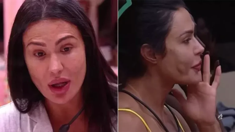 O que tem no rosto de Gracyanne Barbosa? Entenda o que é a ‘bola’ na bochecha da musa fitness