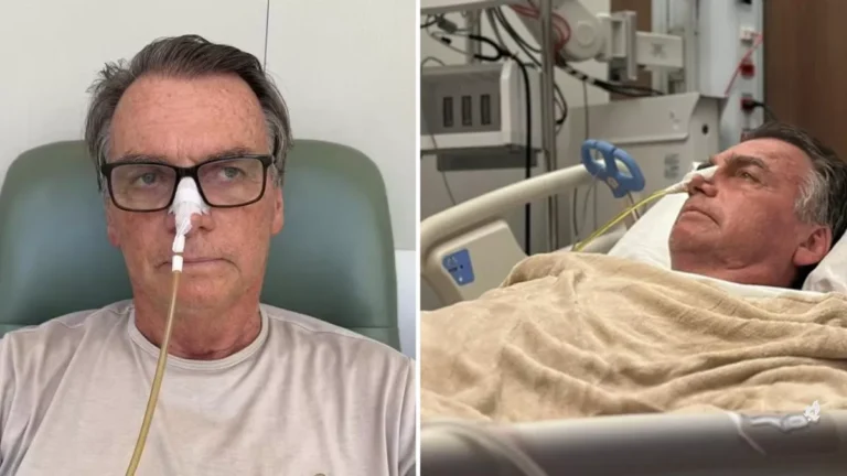 Bolsonaro passa por tratamento para controle de alterações no fígado