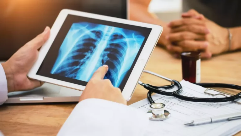 País teve mais de 31 mil casos suspeitos de SRAG até abril, mostra Fiocruz