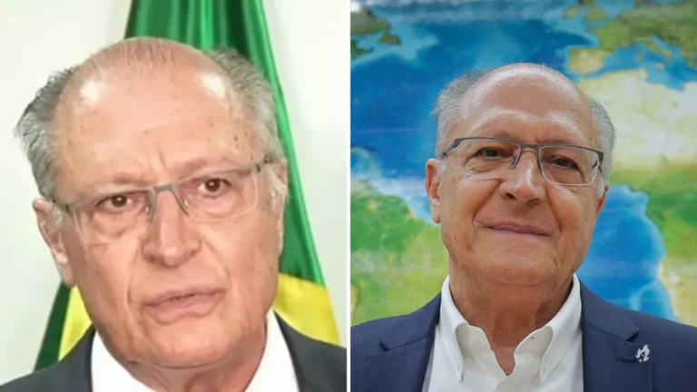 Após receber alta médica, Alckmin brinca, mas revela “má notícia”