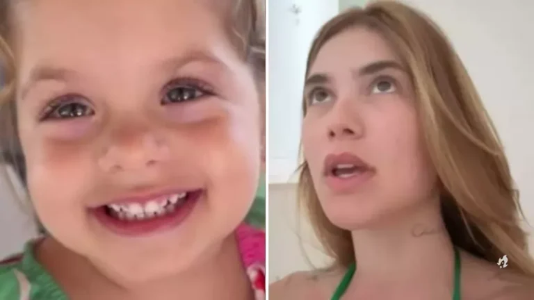 Maria flor, filha de Virginia coloca contenção no dente após acidente