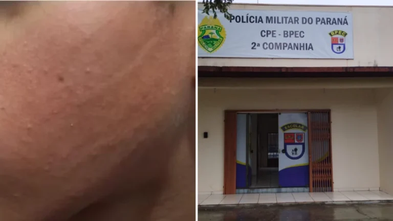 Mãe diz que filho de 13 anos foi agredido dentro da escola por policial