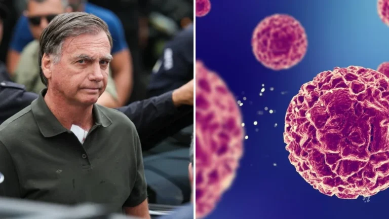 Conheça os sintomas, causas e tratamento do câncer de pele que afetou Bolsonaro