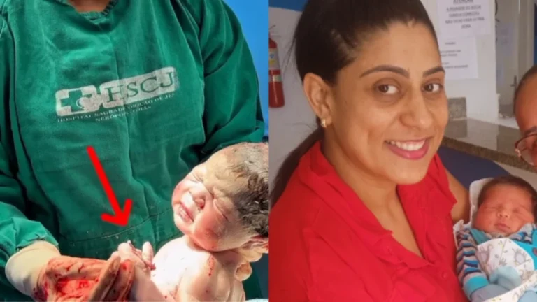 Bebê segura DIU que não impediu gestação e viraliza após parto em GO