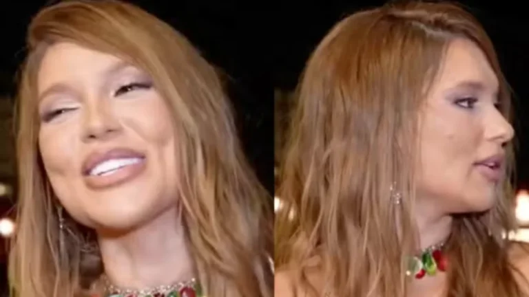 Rosto de Virginia Fonseca em entrevista choca a web: O que aconteceu?