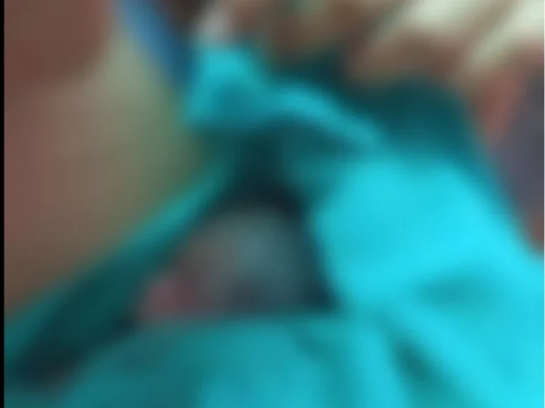 Bebê de 5 meses retirado vivo do próprio velório no Acre: o que se sabe e o que falta esclarecer