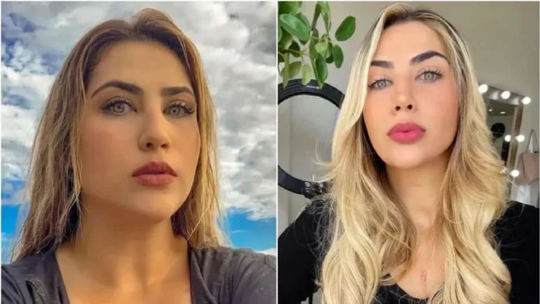 Doente? Filha de Leonardo posa na fazenda do pai e exibe cicatriz no peito