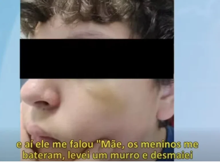 Adolescente brasileiro é agredido em escola em Portugal: Levei um murro e desmaiei