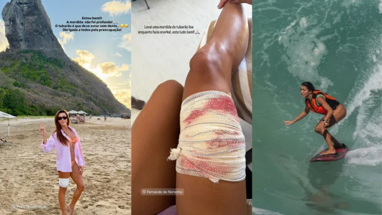 Turista é mordida por tubarão durante mergulho em Fernando de Noronha (PE)