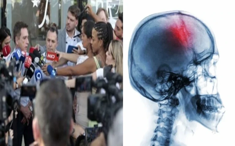 Após diagnóstico, médico explica gravidade do traumatismo craniano de Bolsonaro