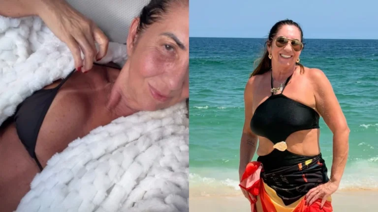 Mãe de Virginia celebra 30 dias de cirurgia com novo procedimento; entenda