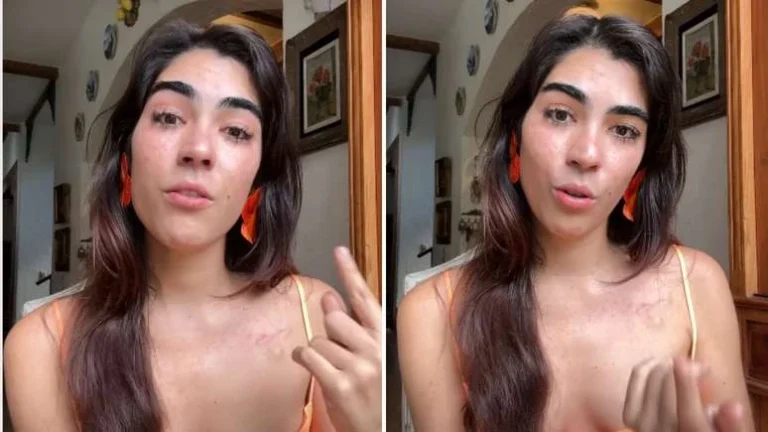 Cantora de 28 anos descobre câncer pela terceira vez: Tumor voltou em cinco pontos