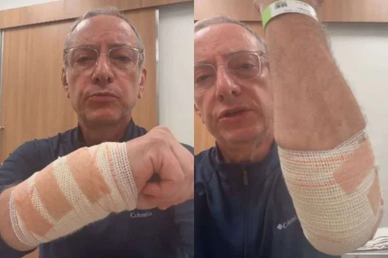 Jornalista da Globo fica gravemente ferido após ataque de pitbull; veja como ele está