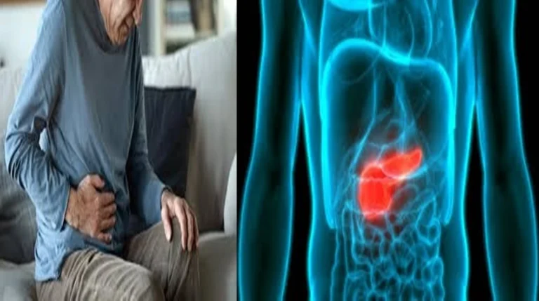 Câncer de intestino: 7 sintomas silenciosos que merecem atenção
