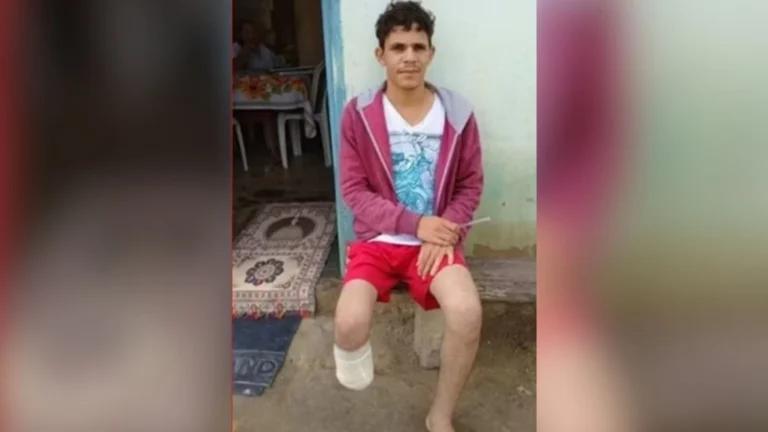 Homem é condenado por amputar o pé para receber seguro milionário na Bahia