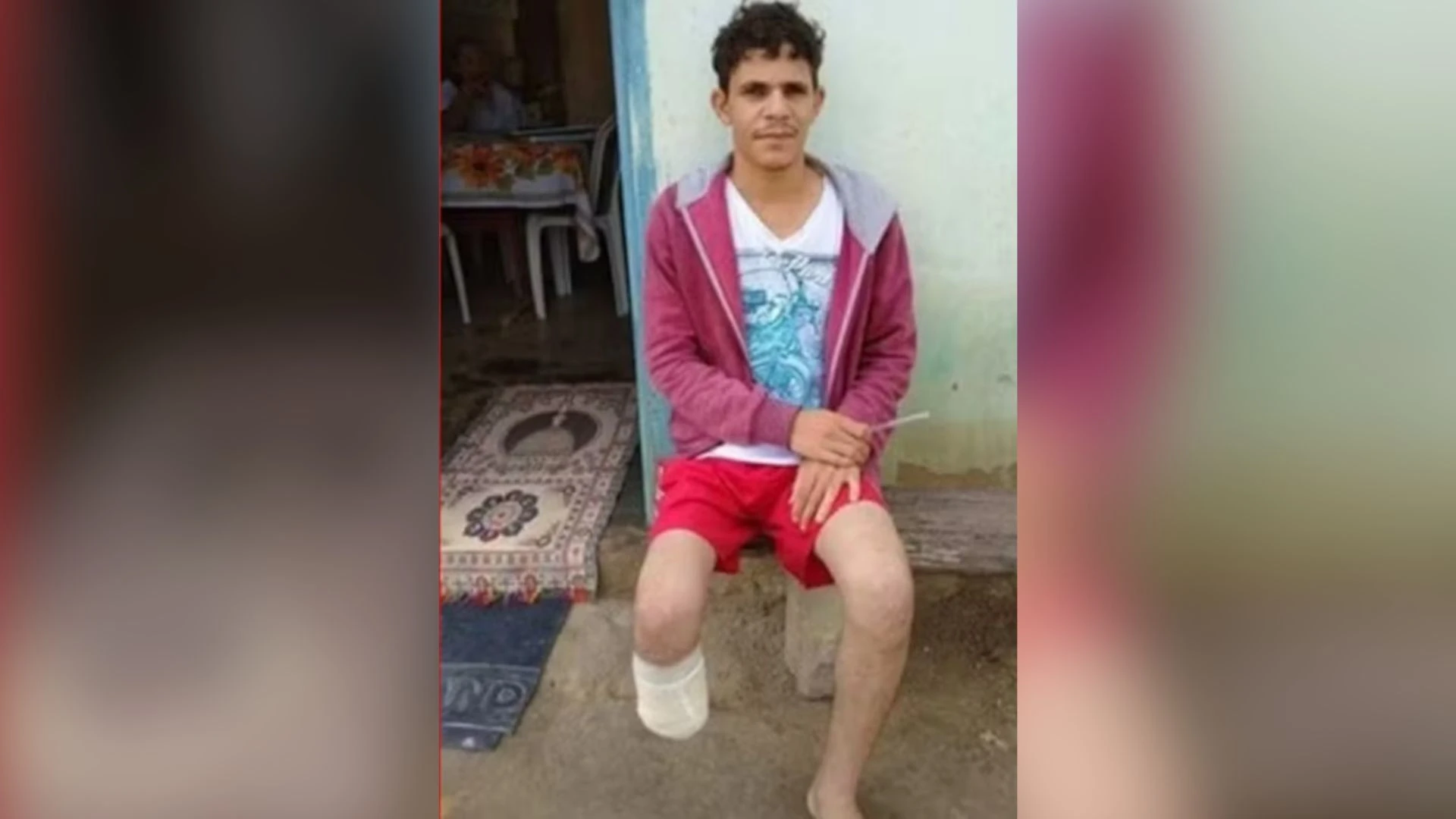 Homem é condenado por amputar o pé para receber seguro milionário na Bahia