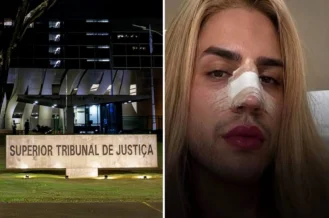 STJ bate o martelo: Planos de saúde terão que cobrir cirurgia facial para pessoas trans