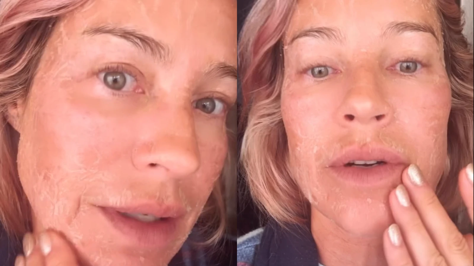 Luana Piovani explica descamação no rosto: 