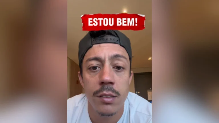 Paralisia de Bell: veja famosos que tiveram o quadro, além de Renato Albani
