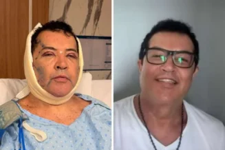 Beto Barbosa surpreende fãs ao mostrar repaginada no visual: 'Tem dois dias que durmo sentado'